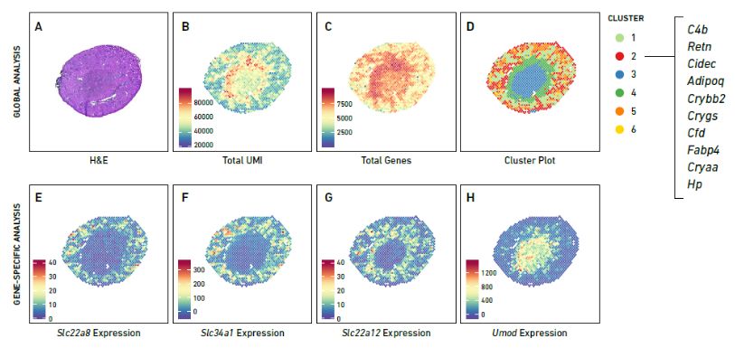 Figure 3. mRNA expression and clustering map of spatial transcriptome. (Source: 10x Genomics)