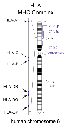 HLA Typing