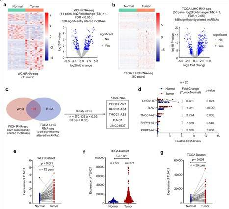 TLNC1 is upregulated in liver cancer tissues