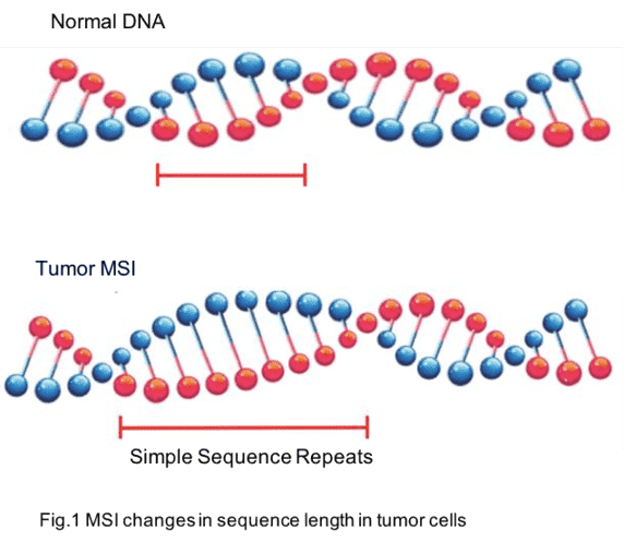Microsatellite Instability Analysis 