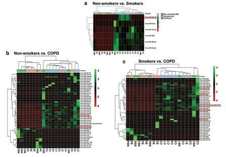 Hierarchical cluster analysis of differentially expressed miRNAs