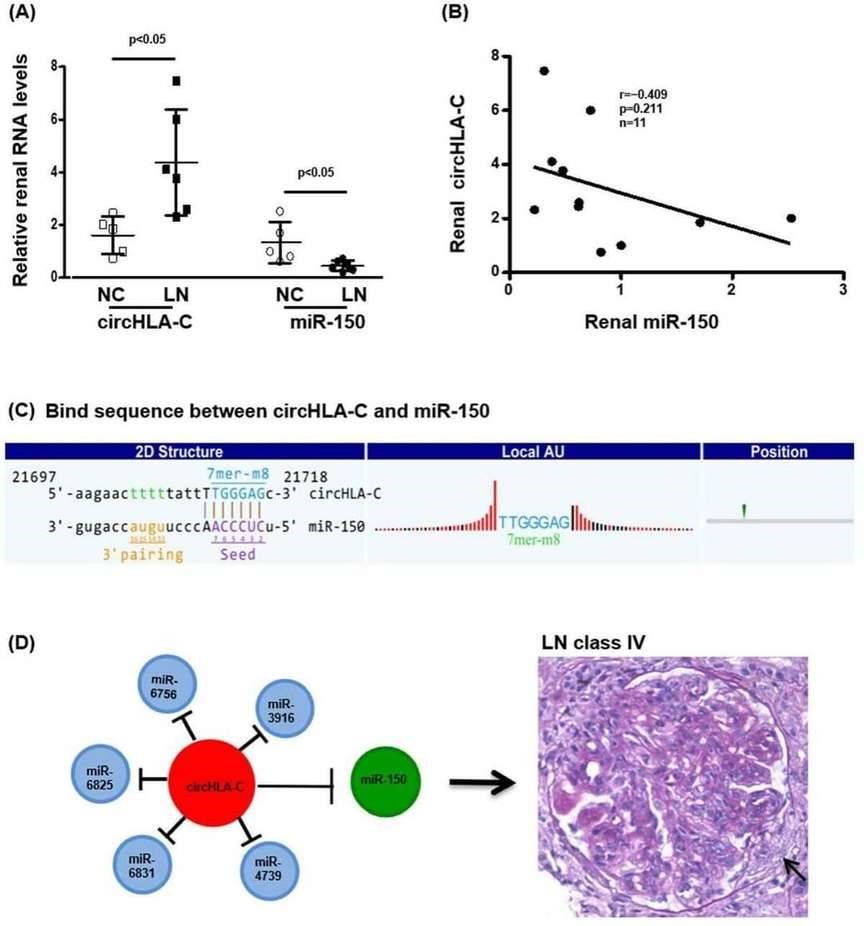 Figure 4. Interaction between renal circHLA-C and miR-150 in LN. (Luan et al., 2018)