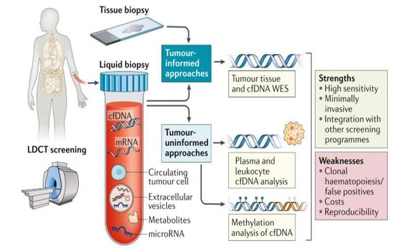 Liquid biopsy for early stage lung cancer.