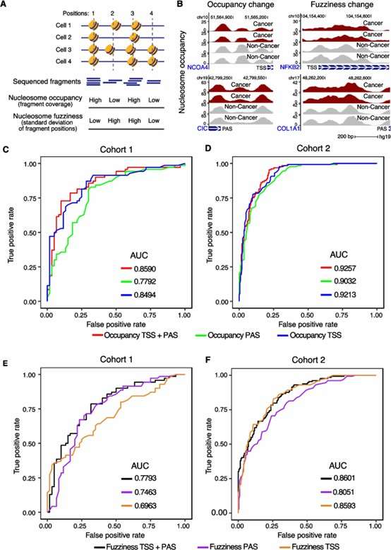 High-accuracy cancer detection using nucleosome occupancy and fuzziness.( Li, Y. et al., 2024)