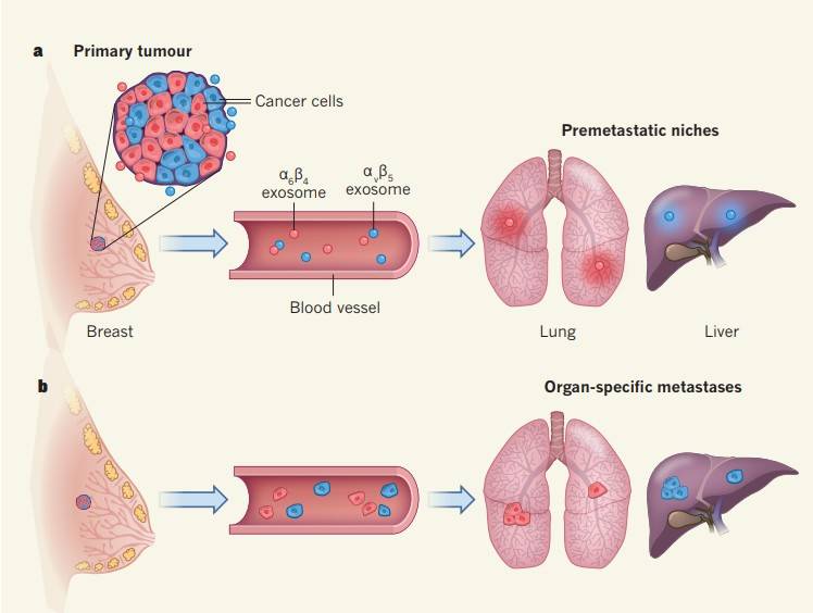 Exosomes determine organ specificity of tumor metastasis