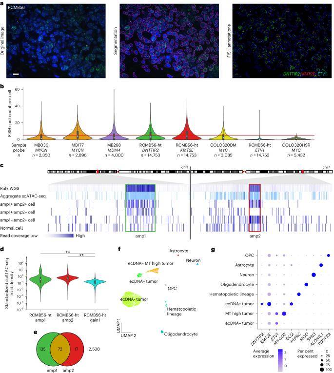 Single-cell analysis reveals a distinct tumor cell population with high-copy ecDNA amplification.