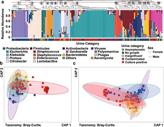 Microbiota composition varies between categories of diagnostic urinanalysis.