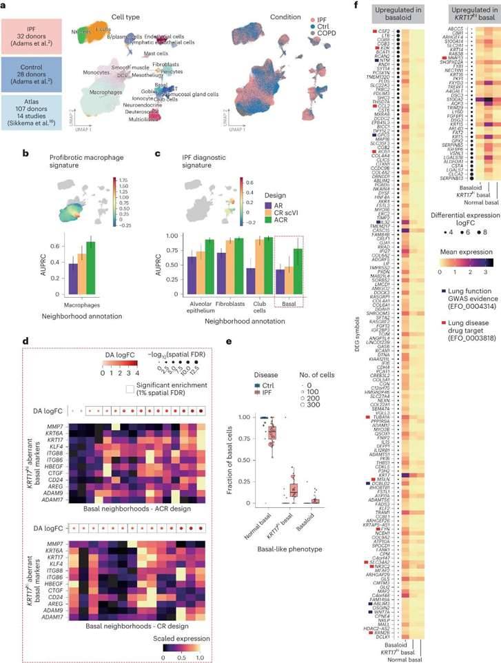 Detection of cell states associated with IPF.