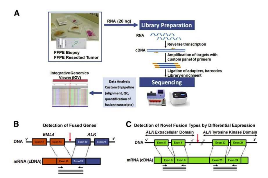 Detecting gene fusions by Next-Generation Sequencing.