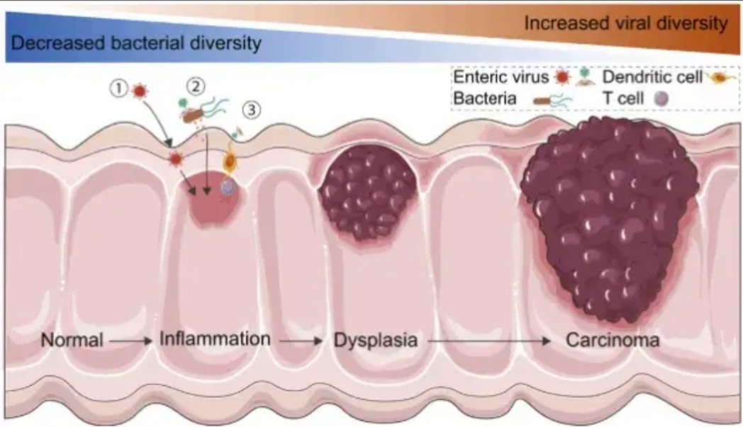 Host-virome interactions in intestinal inflammation and cancer.