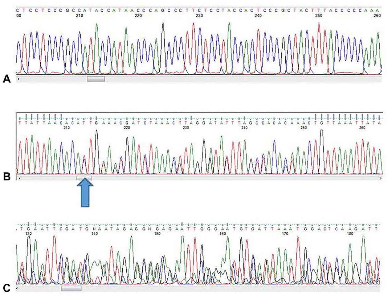 Figure 4. Illustrative Examples of Nucleic Acid Sequences. A High-Quality Sequence. (Crossley et al., Guidelines for Sanger sequencing and molecular assay monitoring, 2020)