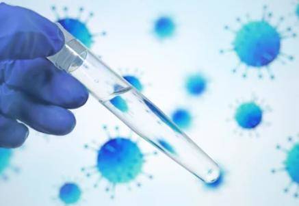 Strategies to Mitigate Common DNA Contamination in Microbial Sequencing