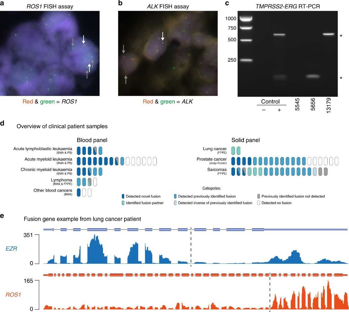 Fig. 1. Detection of fusion genes in clinical cohort samples. (Heyer et al., 2019)