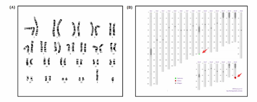 Results of chromosomes karyotype (Lei et al., 2016)