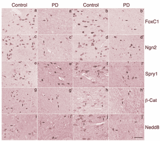 The immunodetection of Foxc1, Ngn2, Spry1, β-Catenin, and Nedd8 in human midbrain.