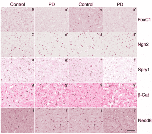 The immunodetection of Foxcl, Ngn2, Spry1, β-Catenin, and Nedd8 in human cerebral cortex